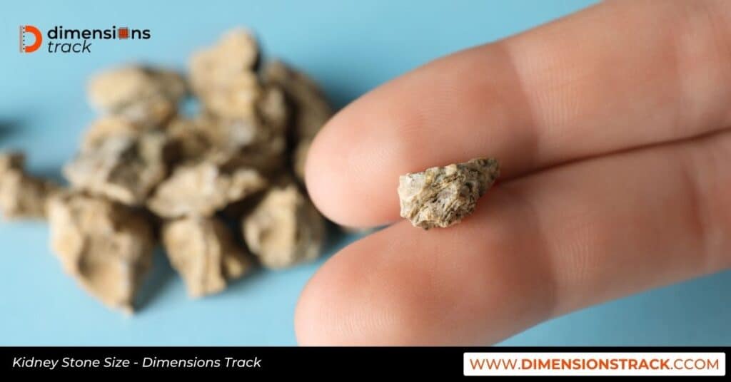 Kidney Stone Size